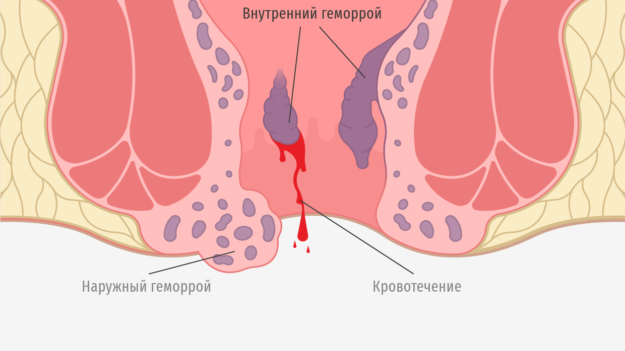 В позе раком - ей больно